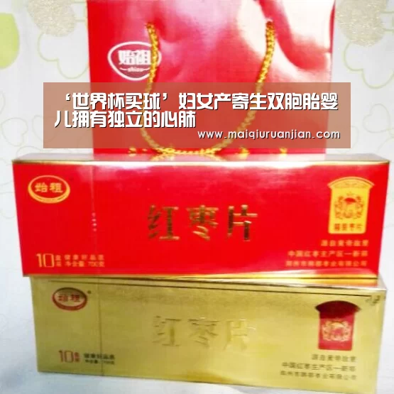 ‘世界杯买球’妇女产寄生双胞胎婴儿拥有独立的心肺(图2) 世界杯买球